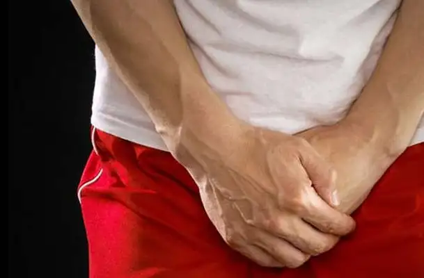 Heboh di Tasikmalaya Cincin Tersangkut di Alat Kelamin Tim Medis Turun Tangan